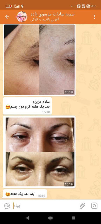 کرم دور چشم برند طب سنتی گیاهی