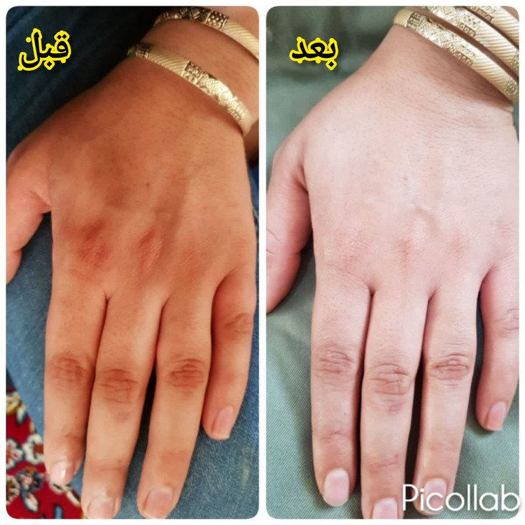 تخفیف ویژه. جوانساز دست پاتضمین کیفیت ارسال رایگان