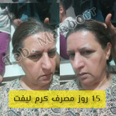 نتیجه کامل کرم معجزه در15 روز