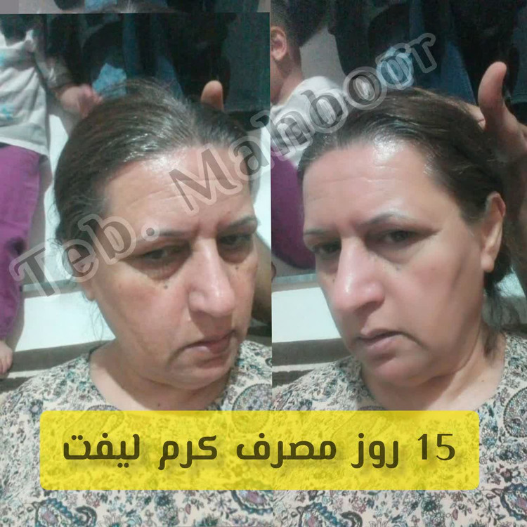 نتیجه کامل کرم معجزه در15 روز