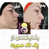 ارسال رایگان درب منزل بسته بندی محکم