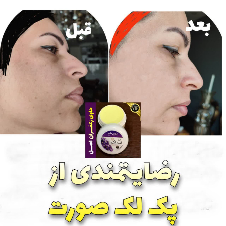 ارسال رایگان درب منزل بسته بندی محکم