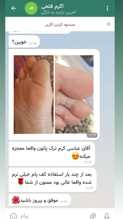 ترک پا برند طب سنتی کیفیت عالی قیمت شگفت انگیز