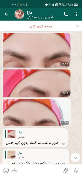 خلاصی از جای ذخم بخیه خرید آنلاین. ارسال رایگان به موقع