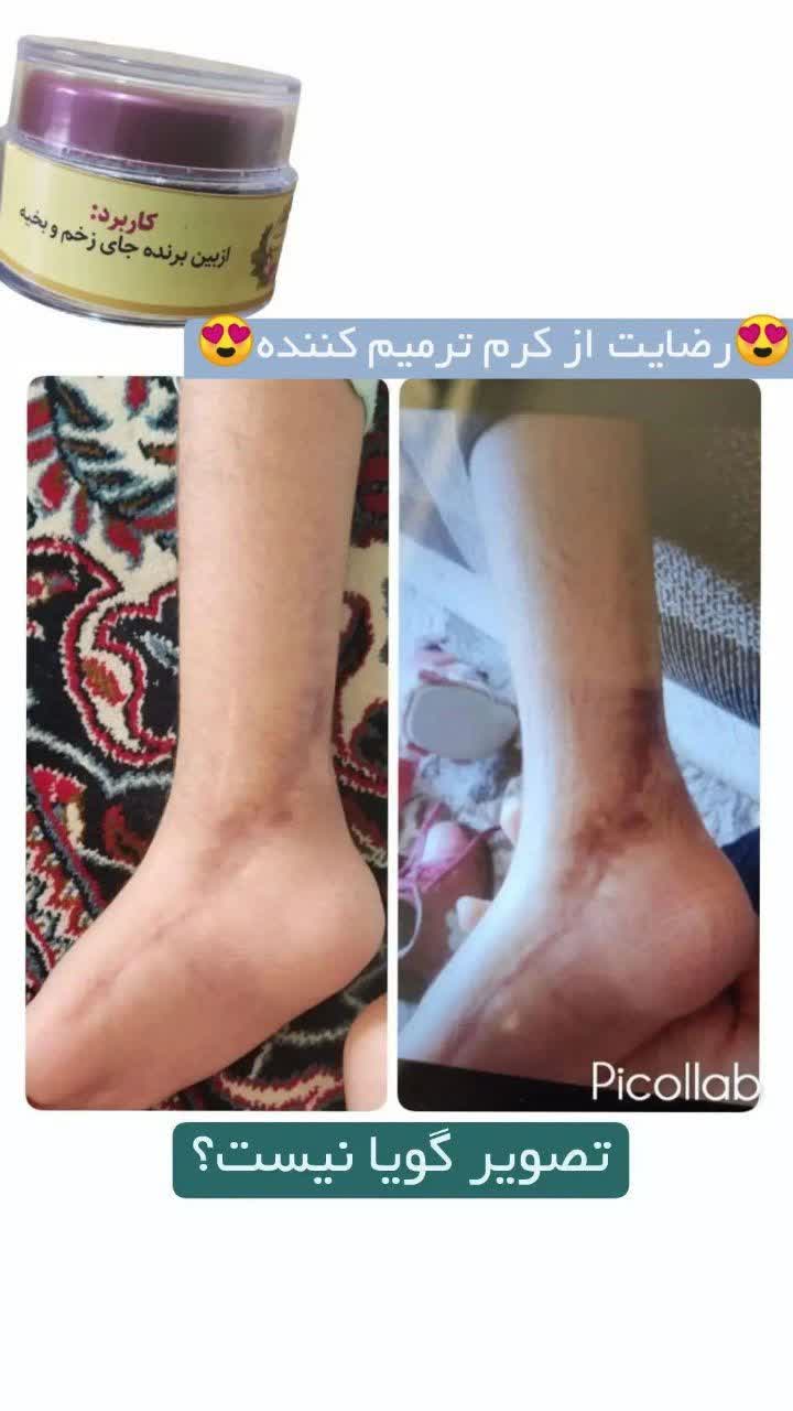 رسال سریع ب موقع بسته بندی محکم  تحویل مشتری