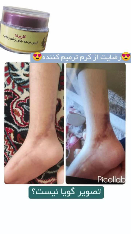 رسال سریع ب موقع بسته بندی محکم تحویل مشتری