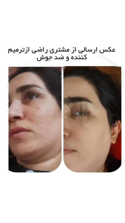 کرم ترمیم کننده قیمت باتخفیف ارسال سریع