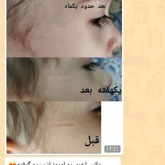 مارک اصل   بهداشت گیاهی ارسال رایگان