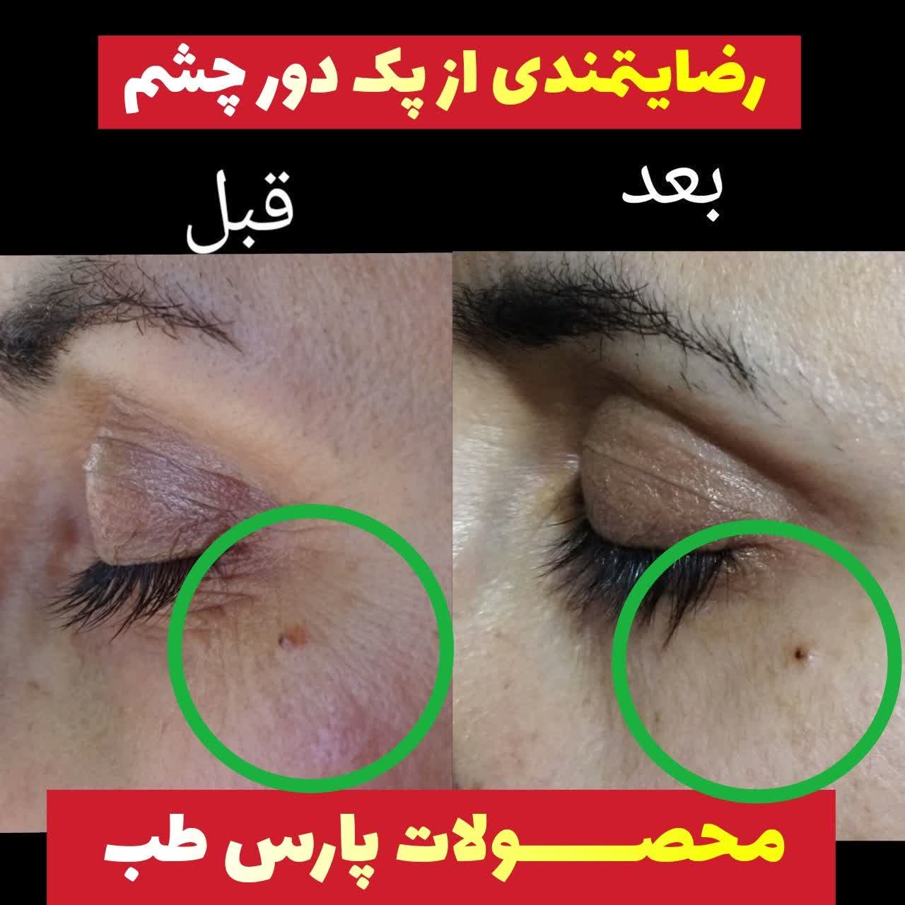 خرید آنلاین ارسال استان کیفیت اصل کالا برند طب سنتی